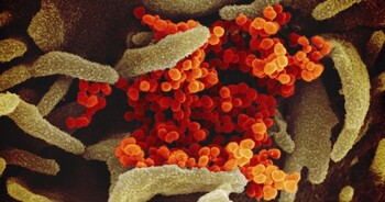 Coronavirus